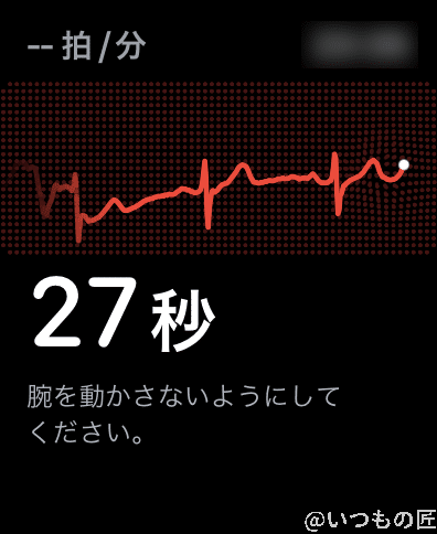 apple-watch-7-electrocardiogram | 真ガジェットレビューの匠 心電図アプリを使うと心電図が計測できるわけですが、専門家でもない素人が定期的に計測するかな…というのはありますね。